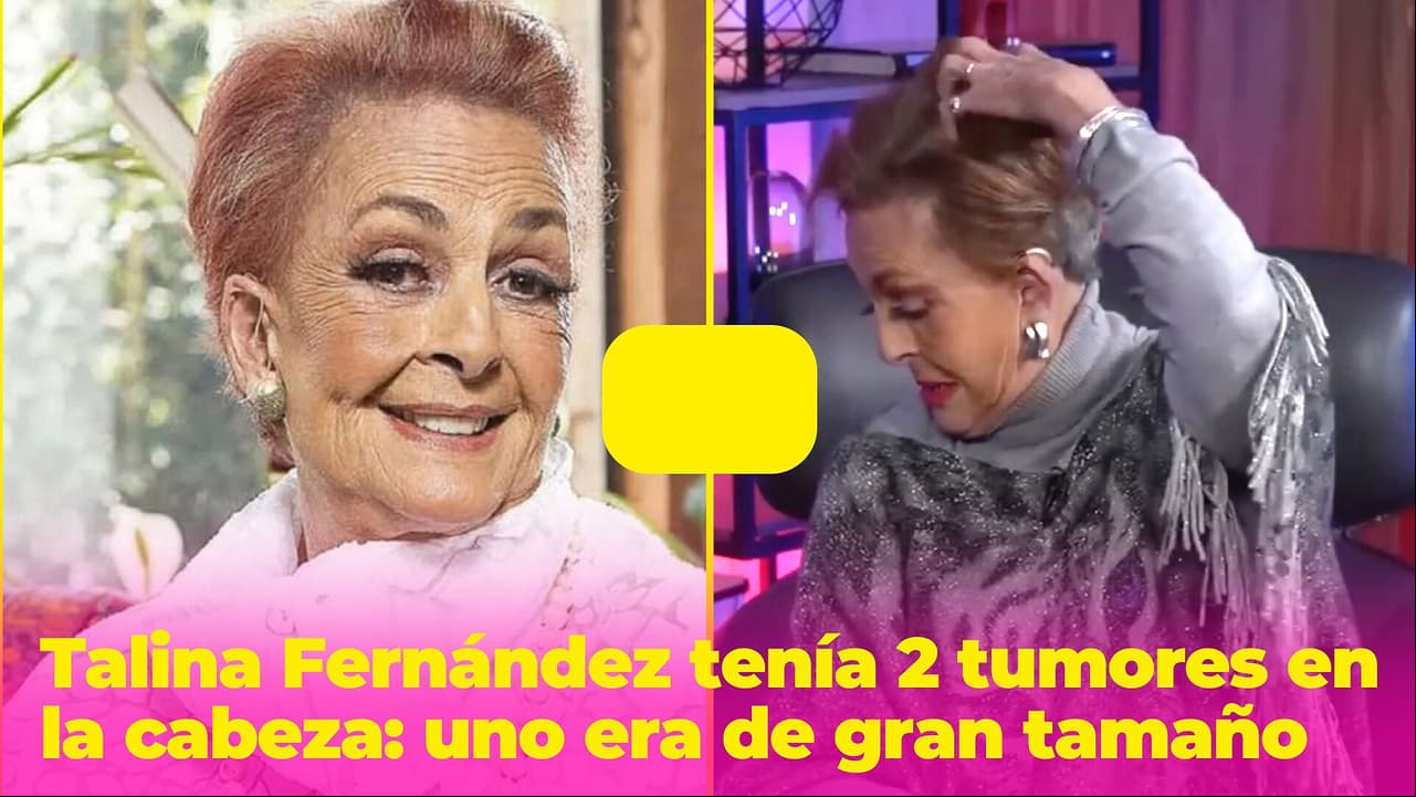 Talina Fernández tenía 2 tumores en la cabeza: quedó pasmada al ver el gran tamaño de uno