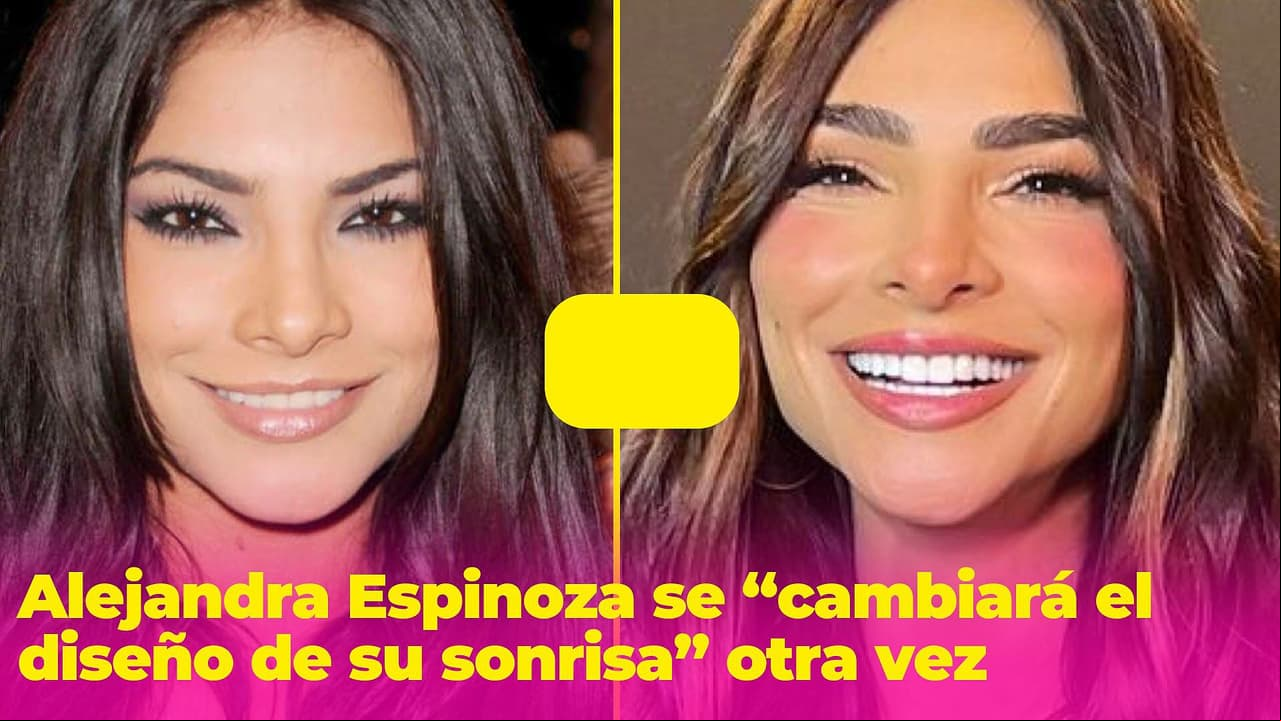 Alejandra Espinoza se someterá a un "diseño de sonrisa” otra vez: “Cambiará muchísimo su rostro”