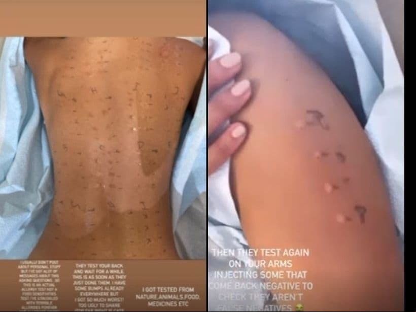Eiza González habla por primera vez del padecimiento que sufre desde niña y de sus alergias.