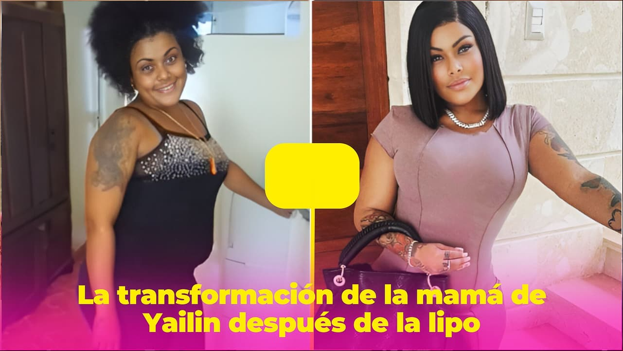 La transformación de la mamá de Yailin: al igual que su hija, se ha hecho varias cirugías