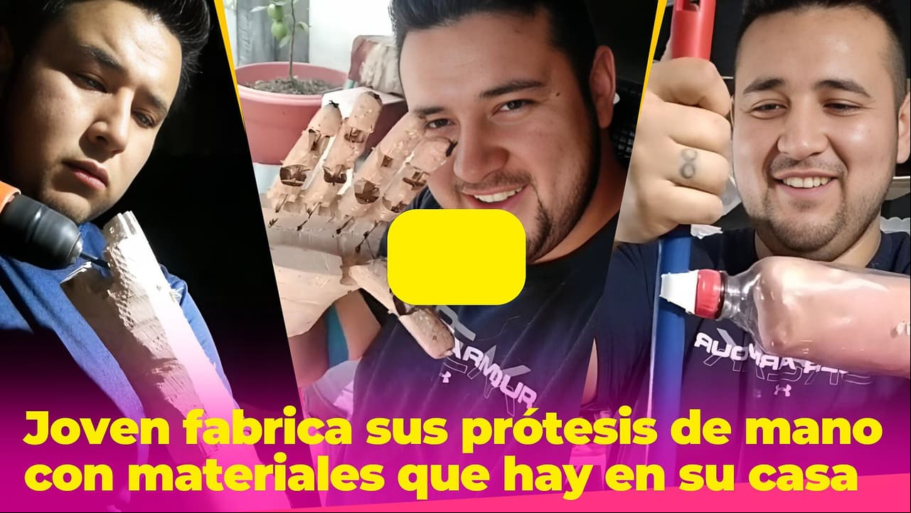 Joven fabrica sus prótesis de mano con materiales que hay en su casa: quiere ayudar a otros a hacerlas
