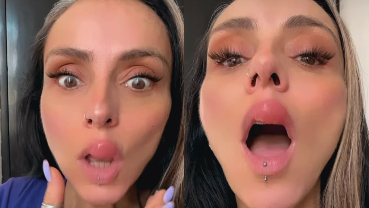 Ivonne Montero aparece con el labio desfigurado y clama ayuda: ¿secuela por "inyectarse" el rostro?