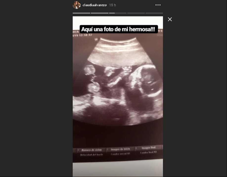 Claudia Álvarez dejó ver a su hija en su último ultrasonido