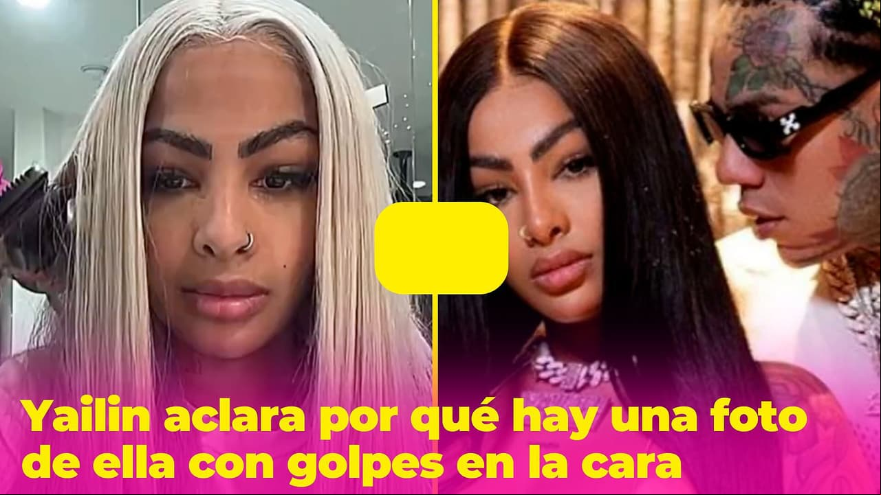 Filtran foto de Yailin golpeada y ella explica qué le pasó: fans preguntan si Tekashi la agredió