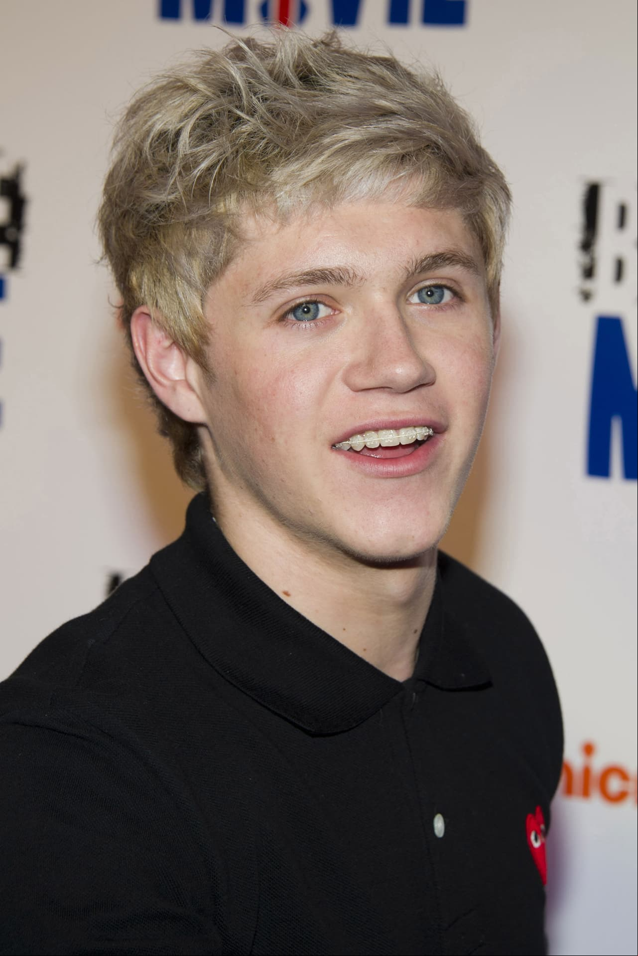 Niall Horan, integrante de One Direction, usó estos aparatos dentales cuando la boyband comenzaba a ser famosa alrededor del mundo.