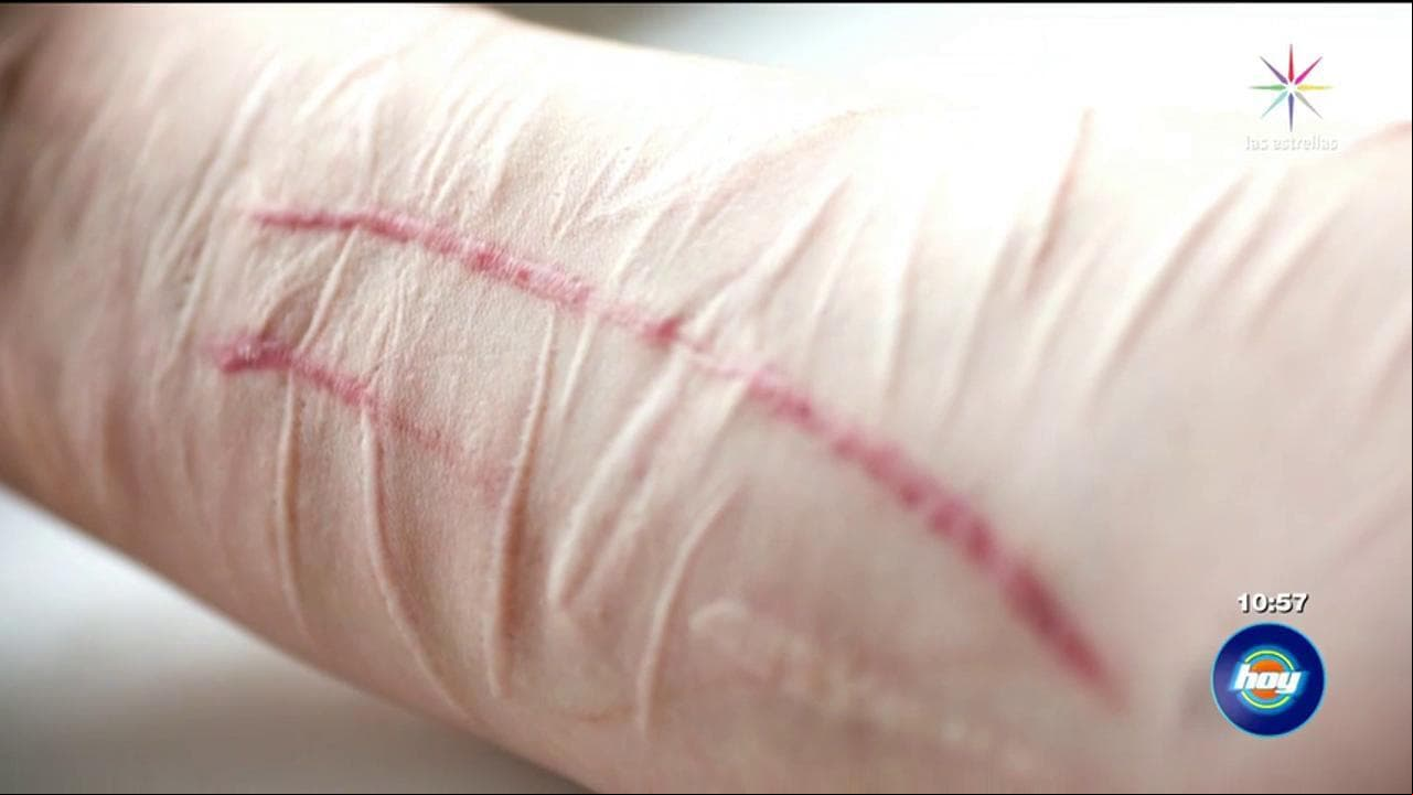 Qué es el &quot;Cutting&quot;