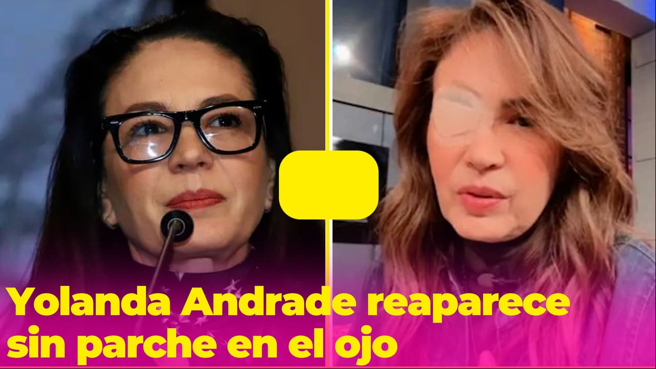 Yolanda Andrade reaparece sin el parche en el ojo y envía mensaje sobre su estado de salud