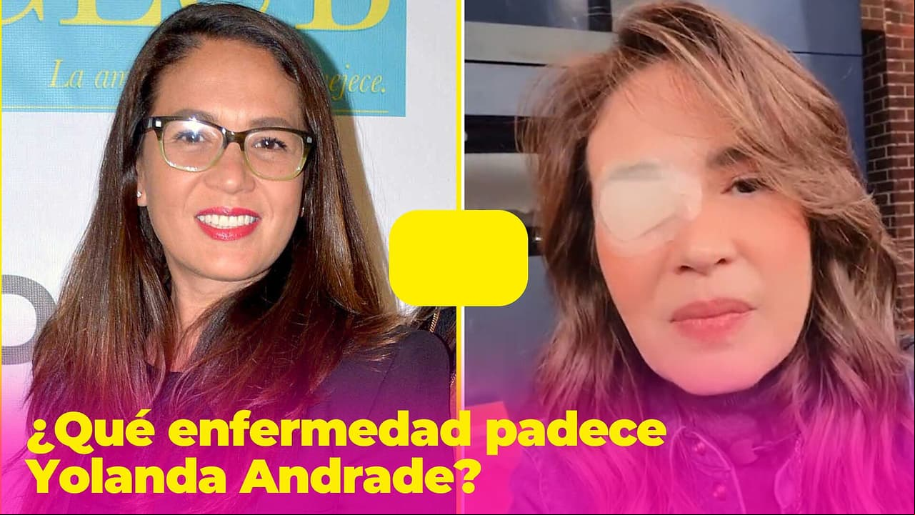 ¿Qué enfermedad padece Yolanda Andrade? El aneurisma en su ojo no fue lo más grave