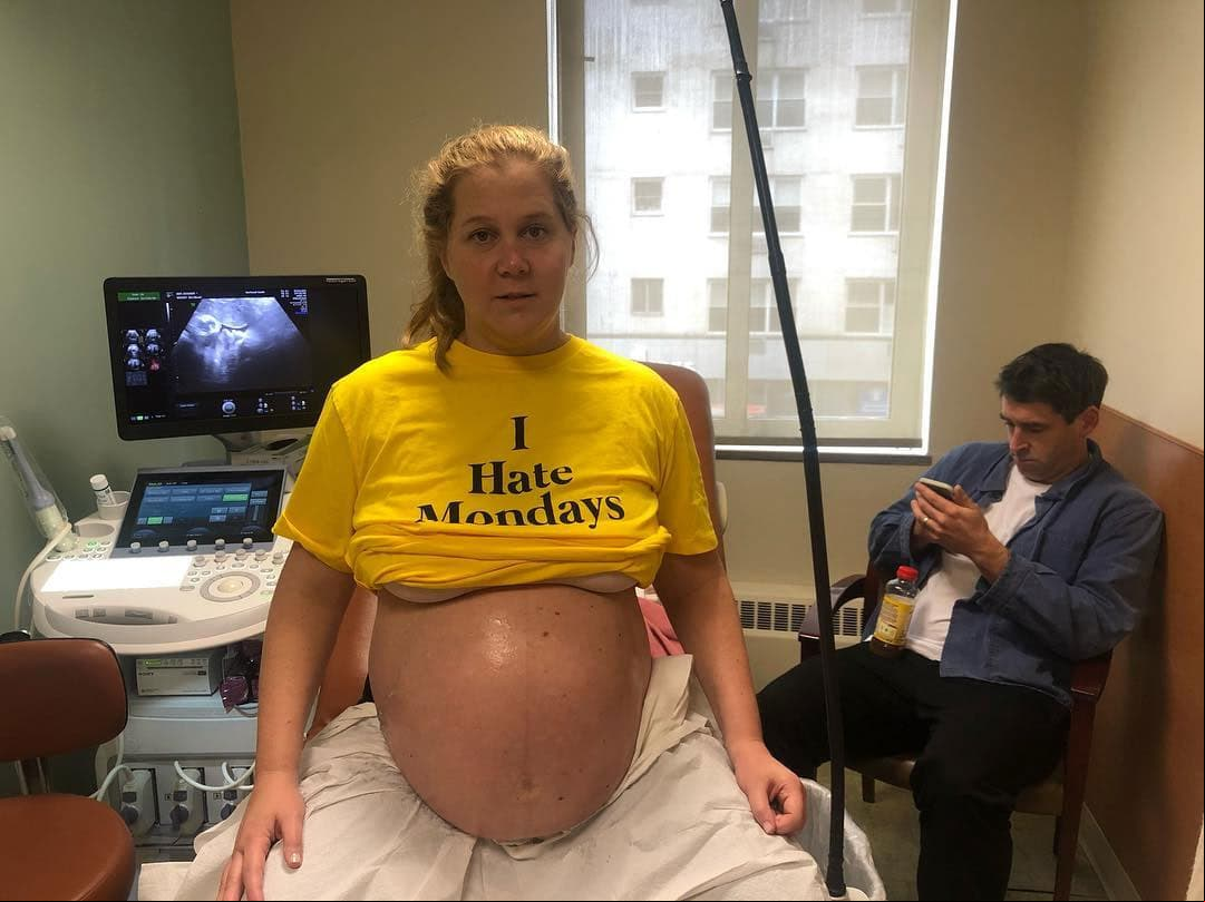 La comediante Amy Schumer ha sido muy sincera al momento de compartir imágenes de su etapa posparto en sus redes sociales.