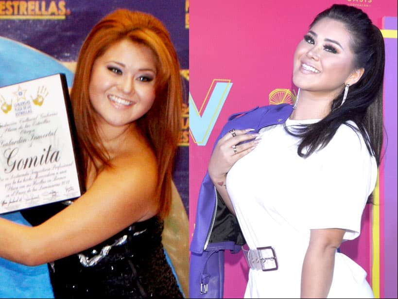 Gomita. La presentadora ha mostrado los resultados de sus cirugías plásticas en sus redes sociales.