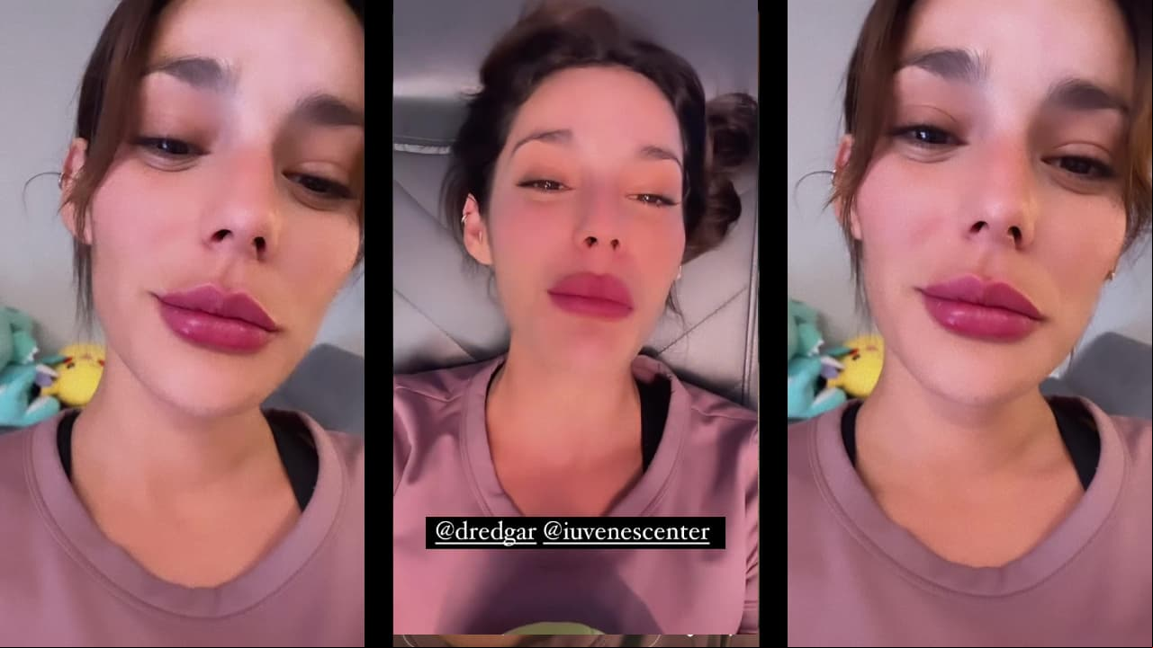 Oka Giner se inyecta los labios y luce irreconocible