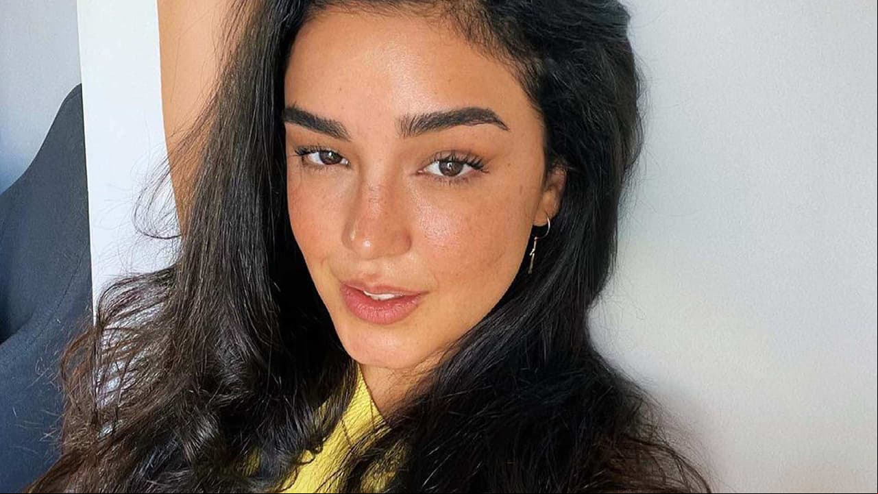 Tras quemarse la cara, hija de Biby Gaytán muestra su cicatriz y afirma: ‘Me traumé’