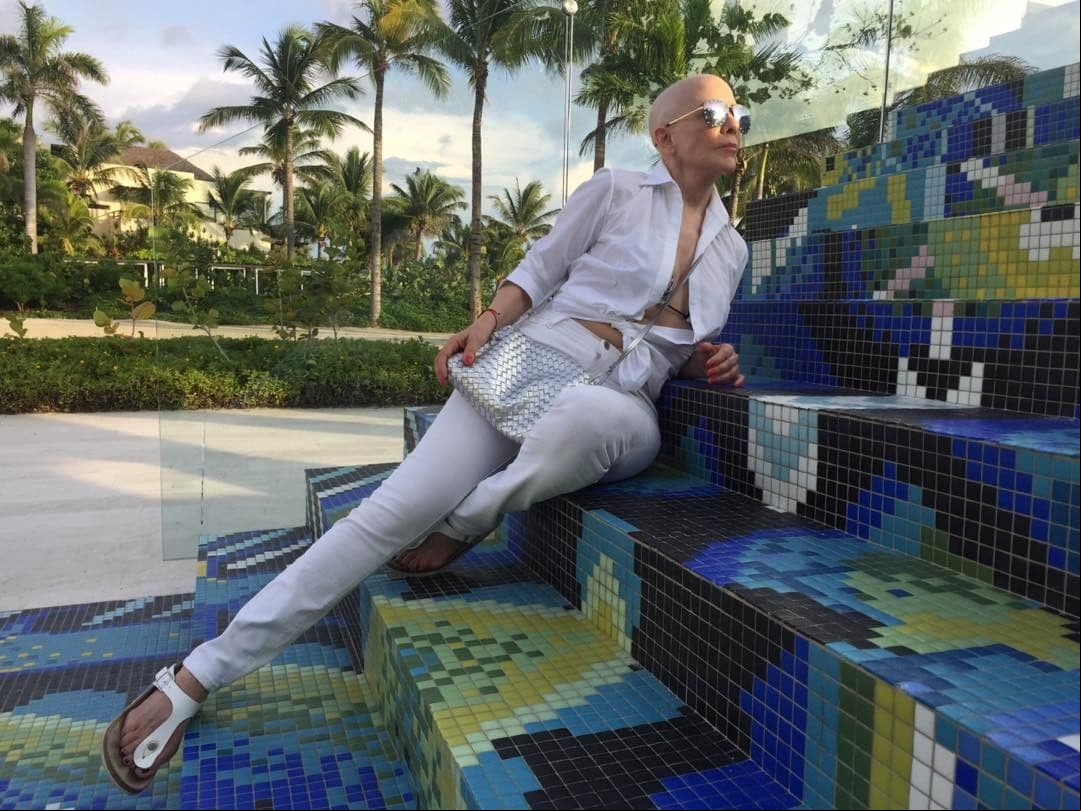Rebecca Jones posa en Instagram sin peluca