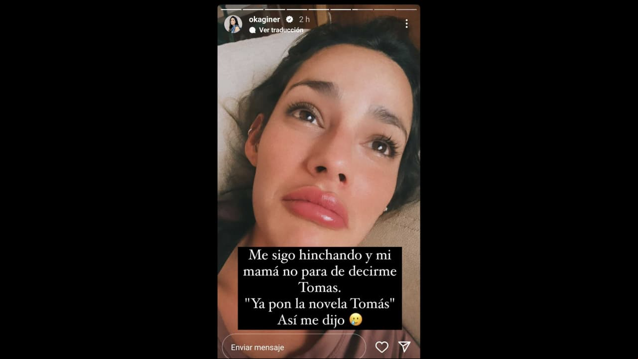 Así luce Oka Giner tras tratamiento estético
