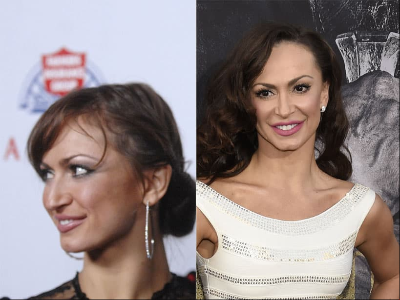 Karina Smirnoff. La bailarina, ganadora de la treceava temporada de ‘Dancing with the stars’, confesó a In Touch Weekly que se sentía genial por su operación. “Es la mejor cosa que me he hecho”.