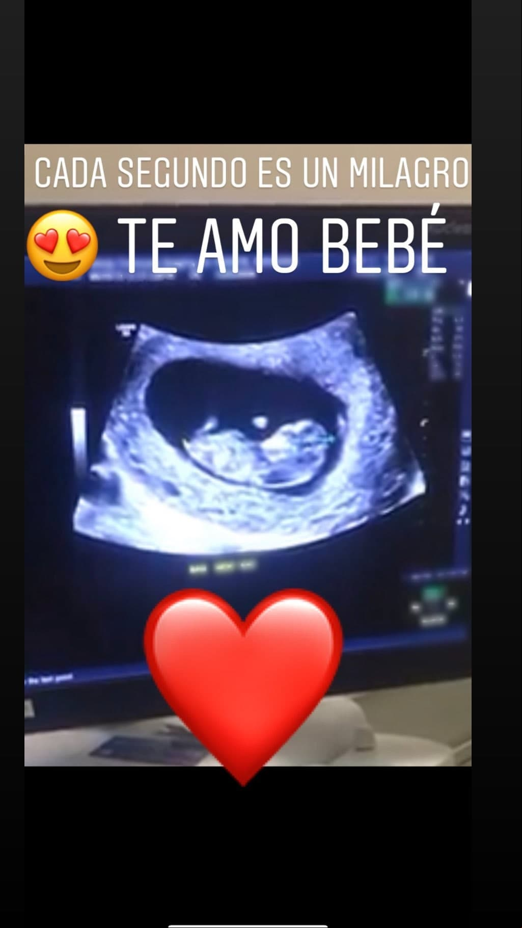 La ex RBD sorprendió a sus más de 6 millones de seguidores con una imagen del nuevo integrante de la familia.