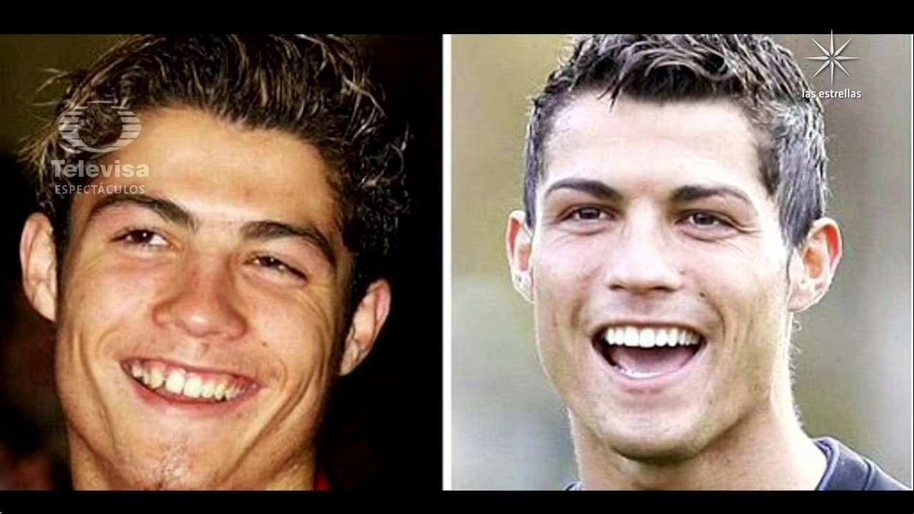 Mira cómo lucían Cristiano Ronaldo, Ronaldinho, Messi y otros futbolistas antes de operarse el rostro