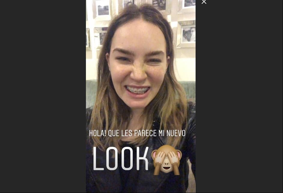 Belinda lució brakets