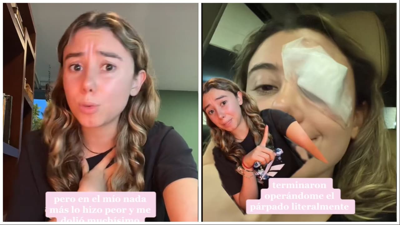 Joven sigue truco de belleza y sale mal.