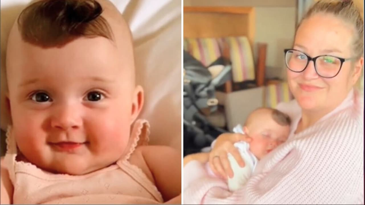 'Bebé unicornio' nace con una marca en la frente y su mamá la defiende de las críticas