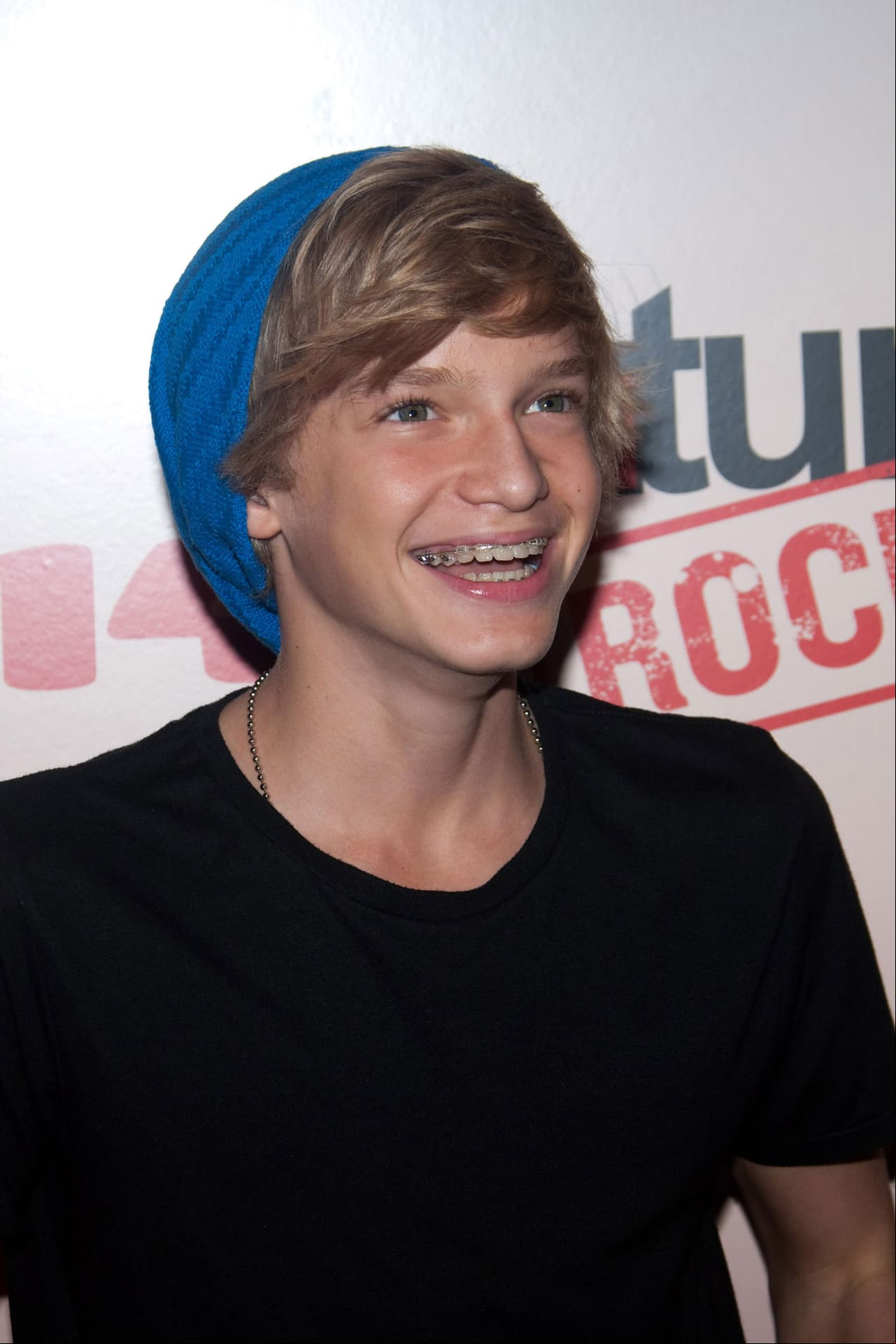 El cantante Cody Simpson utilizó brackets desde que tenía 10 años hasta los 13, itiendo a Radio Disney que sus dientes se sintieron “libres” cuando se deshizo de los aparatos dentales.