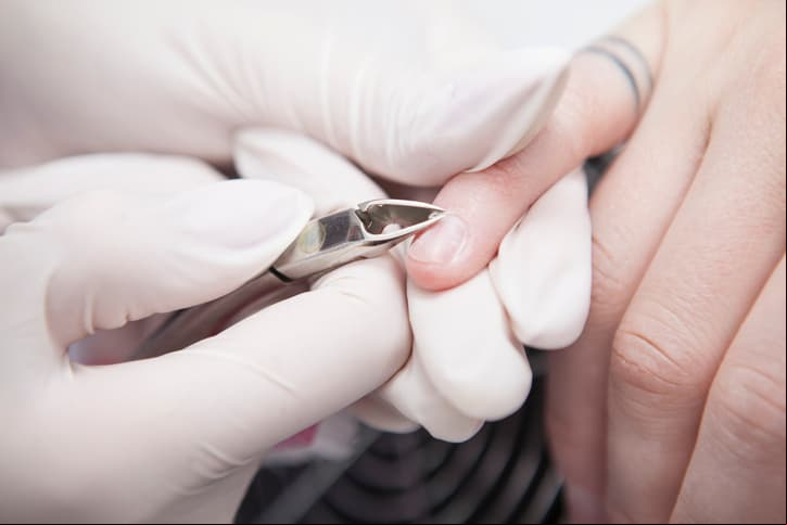 Sufrió una cortada durante una manicura. Meses después le diagnosticaron un cáncer por VPH en la uña