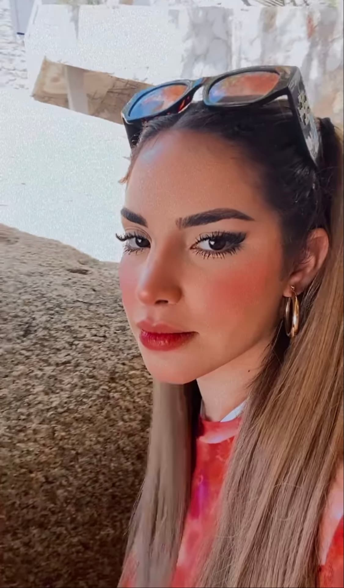 Sin embargo, para los influencers no todo ha sido color de rosa, pues desde los primeros días, Kimberly Loaiza sufrió los estragos del sol, pues, pese a utilizar bloqueador, sufrió quemaduras en cara y cuerpo.