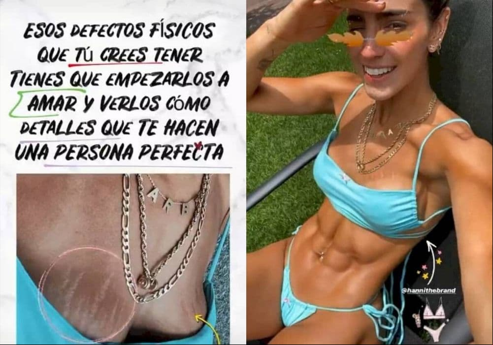 Bárbara de Regil dejó ver las estrías que tiene en el busto